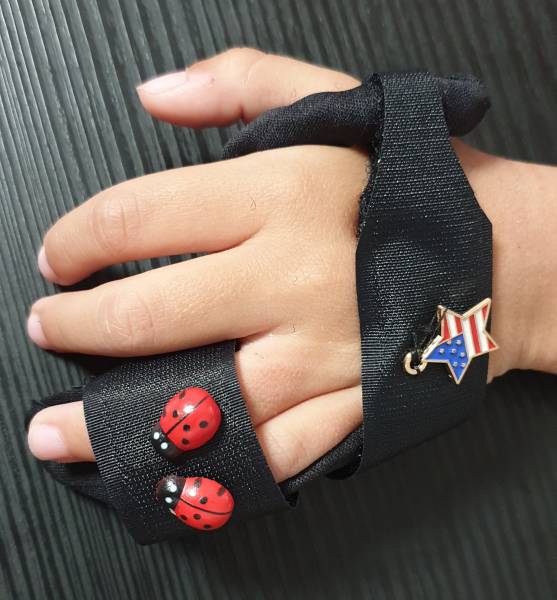 attelle type syndactilie pour fracture des doigts à belgentier