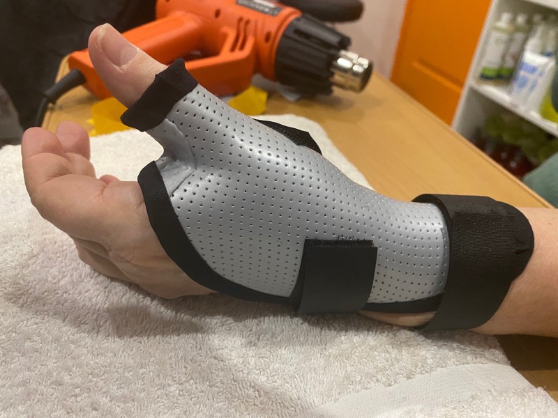 Orthèse thermoformée sur mesure pour arthrose du pouce à Puget ville proche de Toulon dans le Var