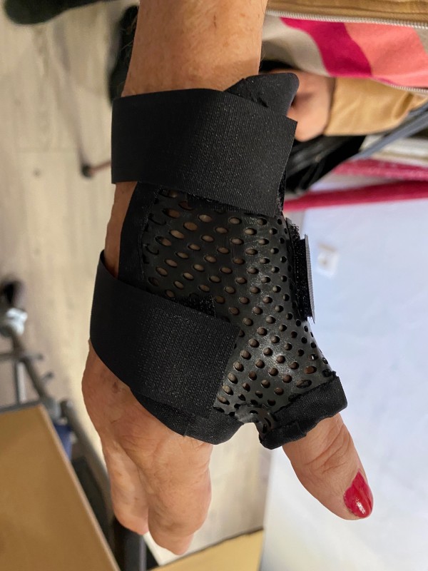 Orthèse thermoformée sur mesure pour arthrose du pouce à Solliès-pont  proche de Toulon dans le Var