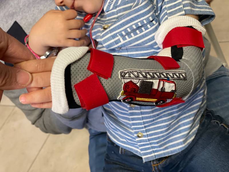 orthèse pour fracture enfant en urgence sur Toulon quartier Saint Jean du Var
