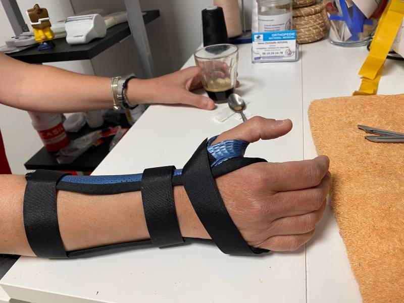 orthese sur mesure pour canal carpien ou douleur cervico bracchiale
