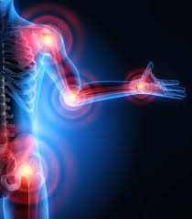 Des solutions pour soulager l'arthrose