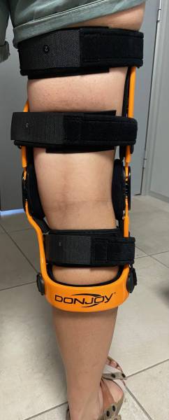 orthèse du genou sur mesure pour entorse du ligament croisé antérieur sur solliès-pont et carnoules dans le Var