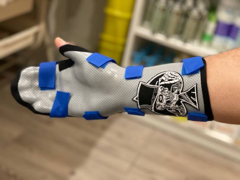 Orthèses thermo-moulée faites sur mesure par notre orthopédiste-orthésiste lors d'un rendez-vous sur Toulon, Solliès-Pont et Carnoules dans le Var
