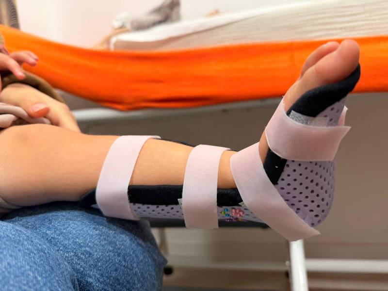 Besoin d’une consultation orthopédique pour pied tourné vers l’intérieur chez l’enfant à Toulon ? Nous proposons des solutions adaptées à la croissance.