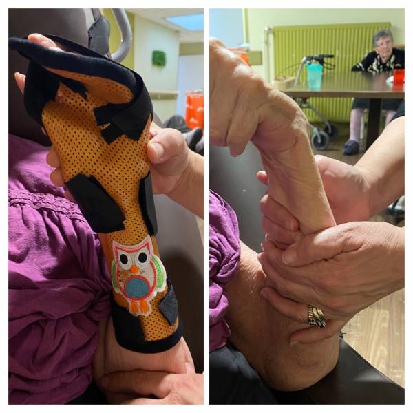 Orthopédie sur mesure des membres inférieurs et supérieurs pour adultes et enfants sur Toulon