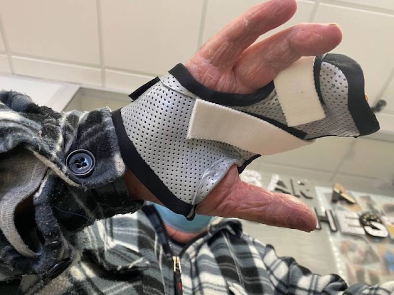 Orthèse thermoformée sur mesure pour fracture adulte à Carnoules proche de Brignoles