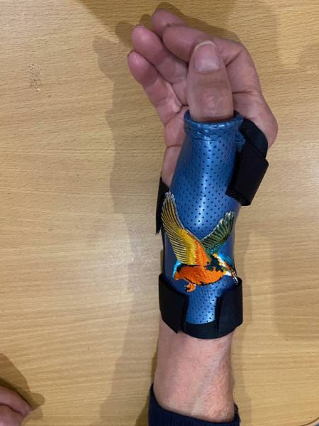 orthèse thermo-moulée sur mesure pour arthrose du pouce sur Solliès-Pont dans le 83