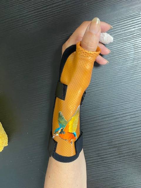 orthese sur mesure pour canal carpien ou douleur cervico bracchiale