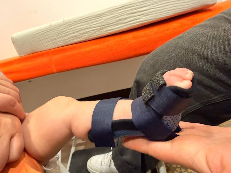 Solutions orthopédiques pour enfants à Toulon : correction du métatarsus varus et amélioration de l’appui plantaire.