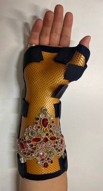 ORTHESE SUR MESURE POUR DOULEUR CANAL CARPIEN POUR IDEL EN URGENCE