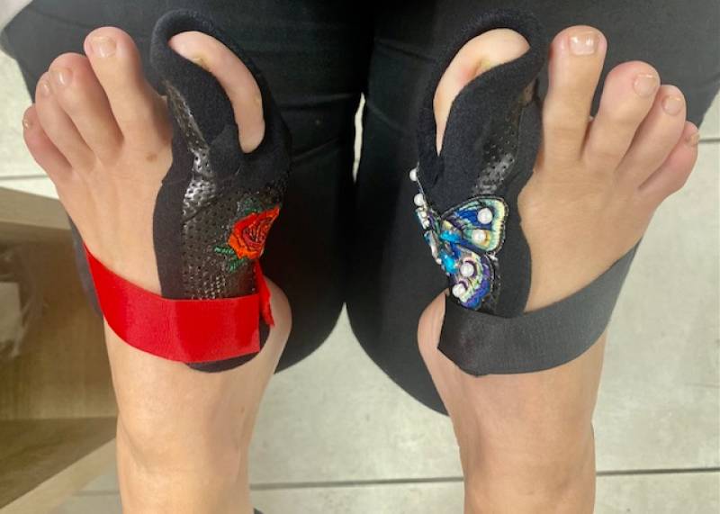 attelle sur mesure de nuit pour hallux valgus sur Toulon près de La Valette du Var