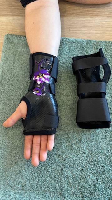 Douleur poignet fourmillements main