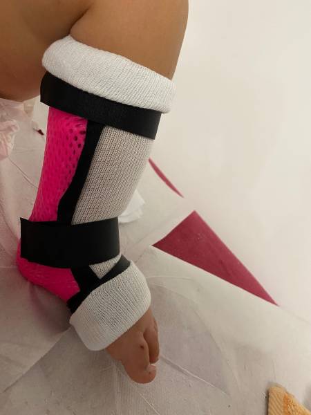 attelle sur mesure pour bébé à Toulon
