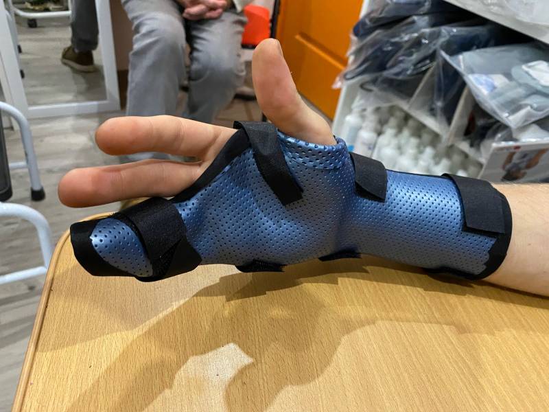 orthèse sur mesure pour enfant suite fracture à hyeres dans le Var