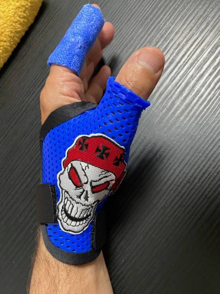 Attelle de poignet avec une extension de doigt sur rendez-vous avec Orthopédiste-orthésiste sur Carnoules et Sollies-Pont en PACA