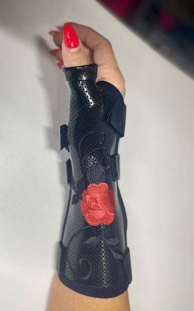 Réalisation d'orthèse sur mesure par un Orthopédiste-Orthésiste sur Carnoules près de Pierrefeu