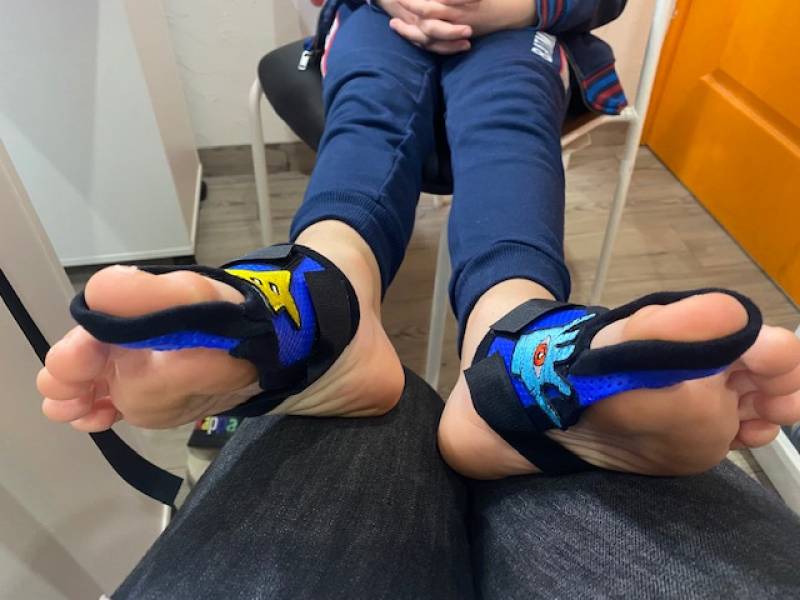 Orthèse sur mesure thermoformable à porter la nuit sur Toulon, Carnoules et Solliès-Pont dans le Var