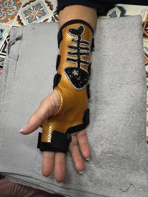 Conception et moulage d’orthèses personnalisées