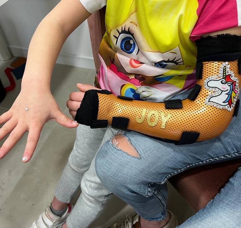orthese sur mesure après mauvaise chute sur toulon près de l'hopital sainte musse