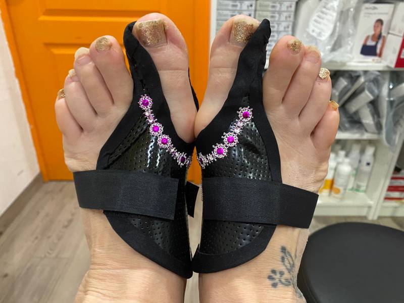 attelle orteil hallux valgus sur Solliès-Pont et Carnoules près de Toulon