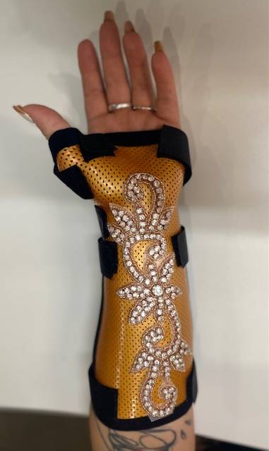 ORTHESE SUR MESURE POUR DOULEUR CANAL CARPIEN POUR IDEL EN URGENCE