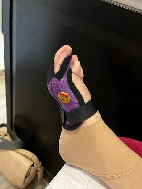 orthese de nuit et de repos pour hallux valgus sur Carnoules près de Pignans