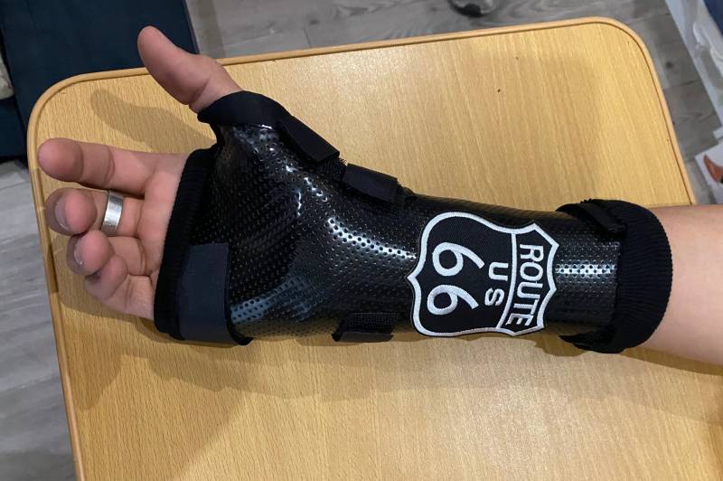 Orthèse pour fracture cubitus sur Carnoules près de Rocbaron