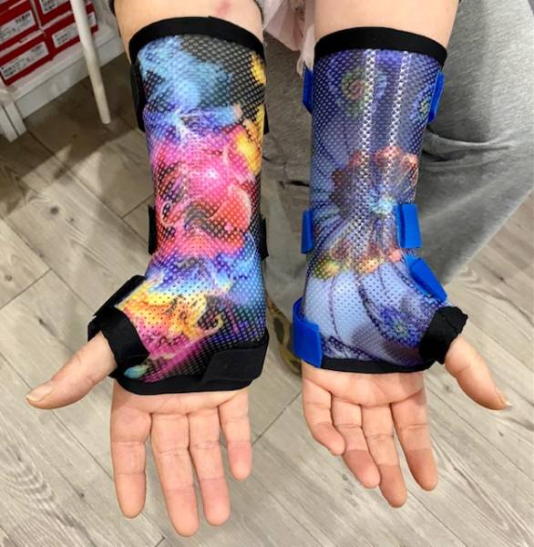 Orthèse thermomoulée sur mesure proche de Cuers à domicile dans le Var