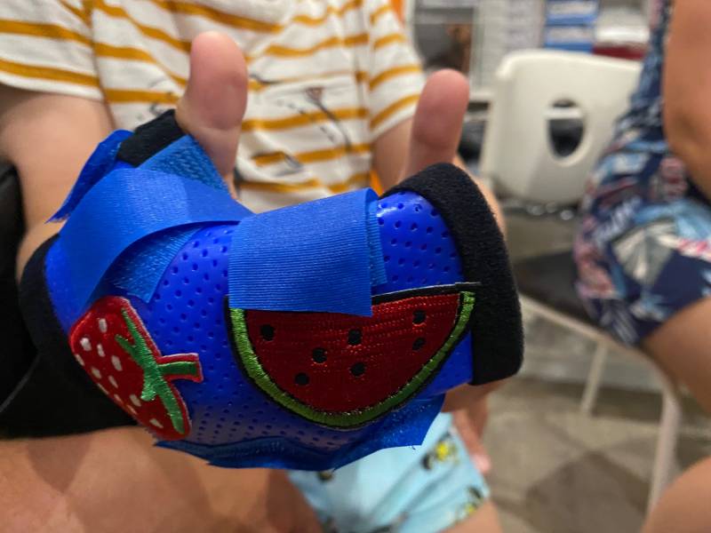 Attelle thermo moulée sur mesure pour adultes et enfants sur Solliès-Pont dans le Var près de Hyeres