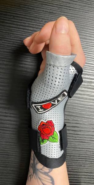 Orthèse thermoformée sur mesure pour fracture adulte et enfant à Carnoules proche de la Londe