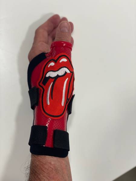 orthèse de pouce thermoformée avec Orthopédiste/Orthésiste dans le Var près de l'hôpital Sainte Musse