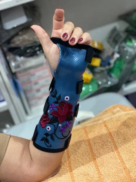 Attelle thermoformée sur mesure personnalisable sur Toulon, Solliès-Ville et Carnoules dans le Var près des Urgences de l'Hôpital de Hyeres