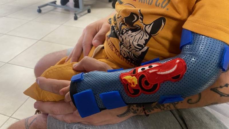Orthèse sur mesure poignet coude pour enfant sur Toulon près d'ollioules