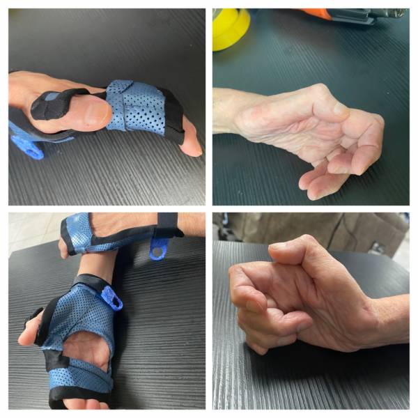 Orthèse thermomoulée sur mesure proche de Cuers à domicile dans le Var