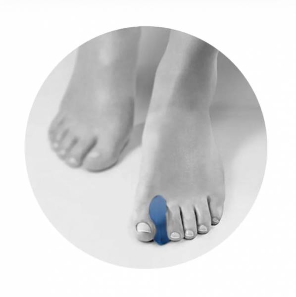 Orthoplastie moulée sur le patient pour corriger une malformation des orteils sur Carnoules dans le Var