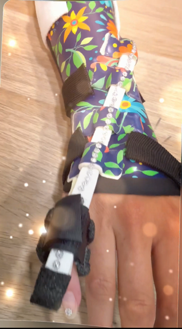 Centre d’orthèse dynamique main Toulon