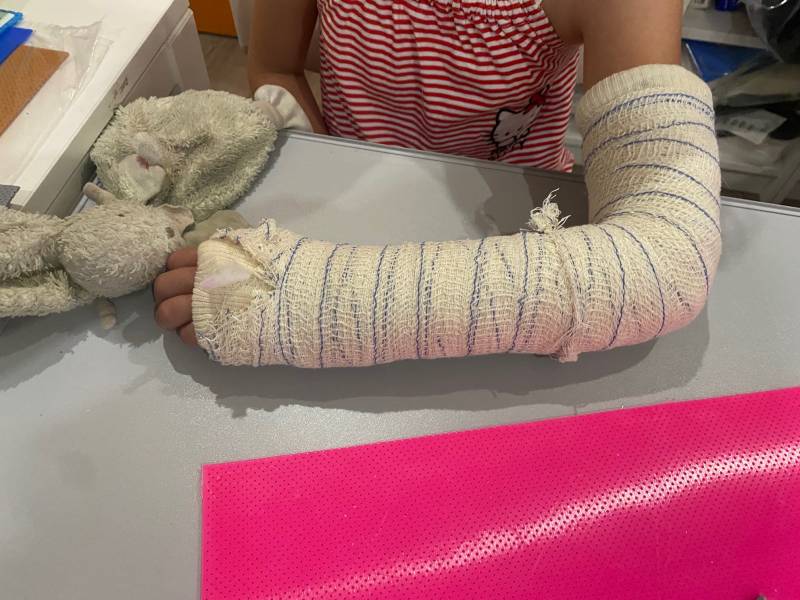 Enlèvement d'un plâtre pour une attelle plus légère