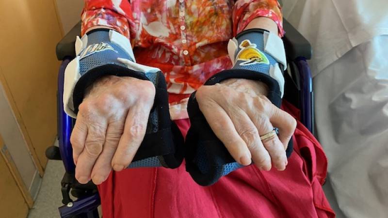 orthèse pour une polyarthrite rhumatoide déformante sur Toulon près de Hyères