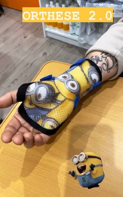 attelle thermoformée sur mesure et personnalisée sur Carnoules dans le 83