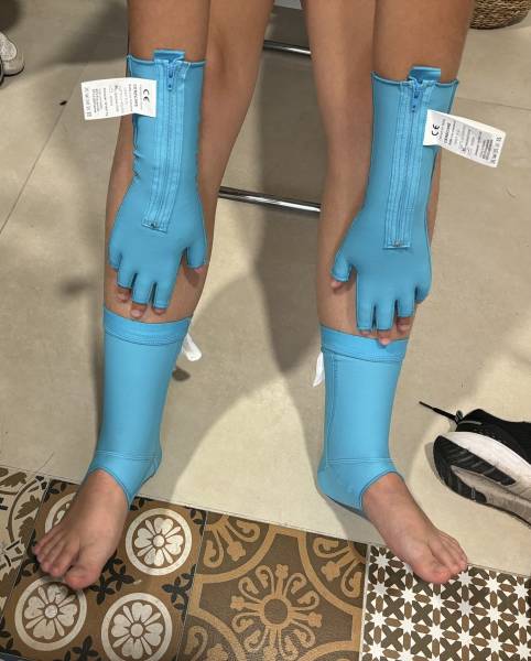 vêtements thérapeutiques pour soulager et éviter les déformations